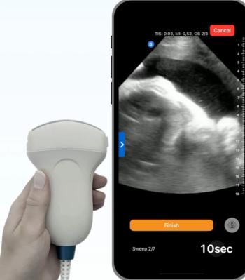Emerging Prenatal Ultrasound Device Gets FDA’s Breakthrough Device Designation