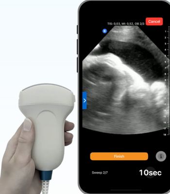 Emerging Prenatal Ultrasound Device Gets FDA’s Breakthrough Device Designation