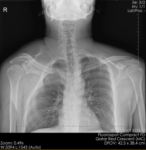 Image IQ Quiz: Patient Presents for an Evaluation of Scoliosis