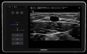 Could an Emerging Ultrasound Device Facilitate More Efficient Vascular Access Workflows?