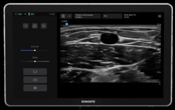 Could an Emerging Ultrasound Device Facilitate More Efficient Vascular Access Workflows?