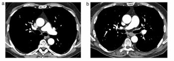 Photon-Counting Computed Tomography: Eleven Takeaways from a New Literature Review