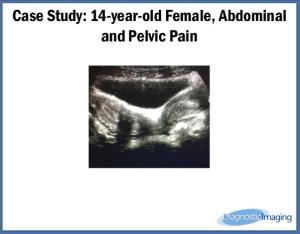 14-year-old Female, Abdominal and Pelvic Pain