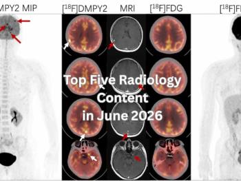 Top Five Radiology Content in June 2026
