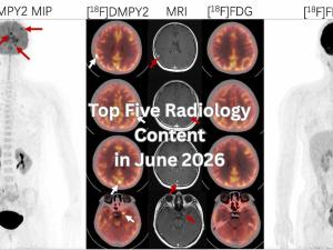Top Five Radiology Content in June 2026