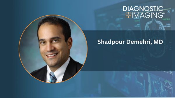 What New CT and MRI Research May Reveal About Bone Loss, Diabetes and Cognitive Decline