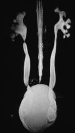 New training course focuses attention on urinary tract