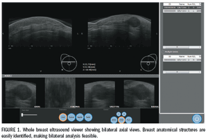 Whole-breast ultrasound brings significant screening benefits