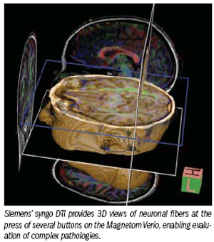 Siemens taps technology to boost performance