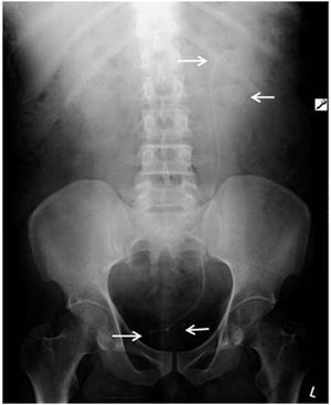 Poster shows computed radiography artifacts and their solutions