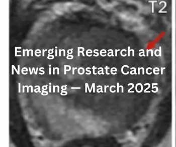 Emerging Research and News in Prostate Cancer Imaging — March 2025