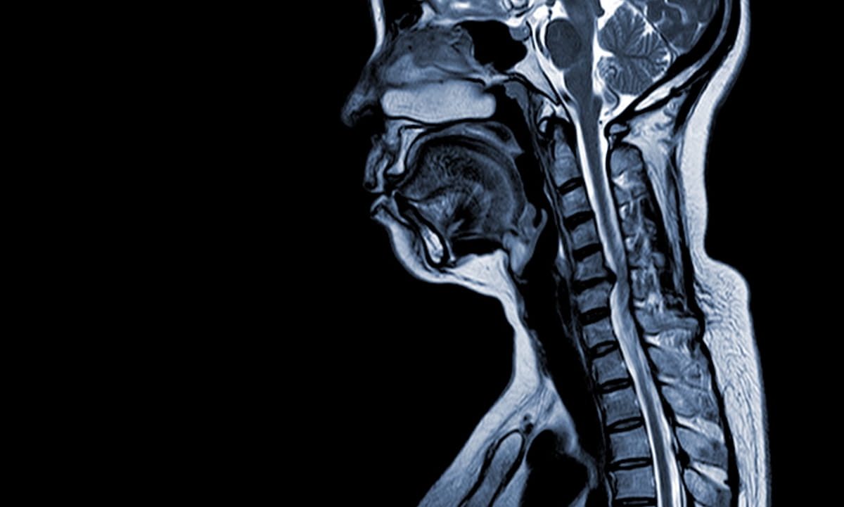 The Case of the Mystery MRI