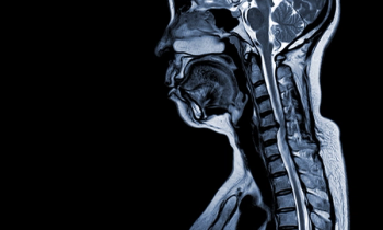 The Case of the Mystery MRI