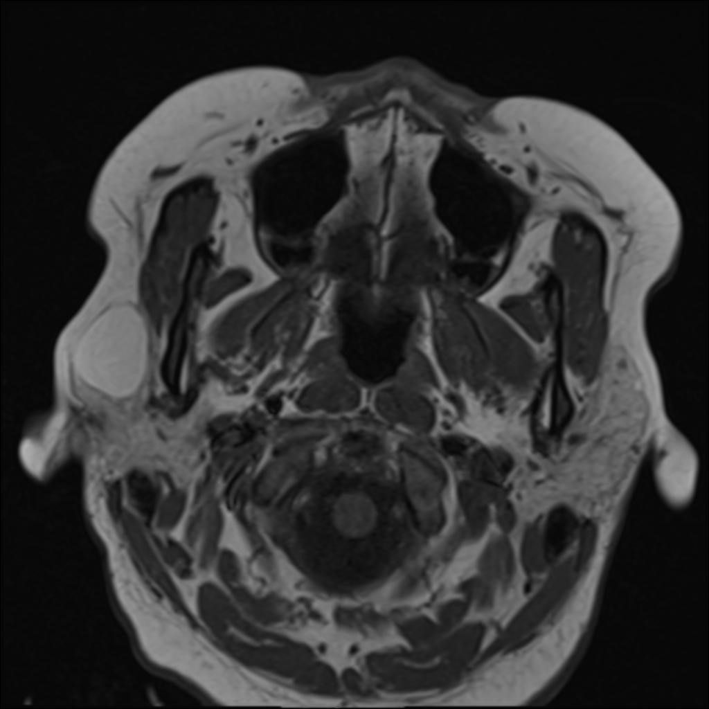 Image IQ Right Face Swelling Diagnostic Imaging