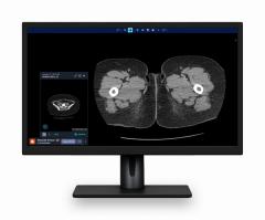 : For related content, see “Study Finds Non-Contrast CT 30 Percent Less Accurate than CECT for Abdominal Pain in the ER”  “Study Finds That Over 70 Percent of Emergency CT Referrals Are ‘Inadequate’”  “FDA Issues Breakthrough Device Designation for AI-Powered Multi-Triage System for Computed Tomography”