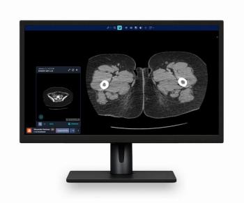 : For related content, see “Study Finds Non-Contrast CT 30 Percent Less Accurate than CECT for Abdominal Pain in the ER”  “Study Finds That Over 70 Percent of Emergency CT Referrals Are ‘Inadequate’”  “FDA Issues Breakthrough Device Designation for AI-Powered Multi-Triage System for Computed Tomography”