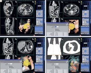 Improved Evaluation and Follow-up of Routine Diagnostic Oncology Exams