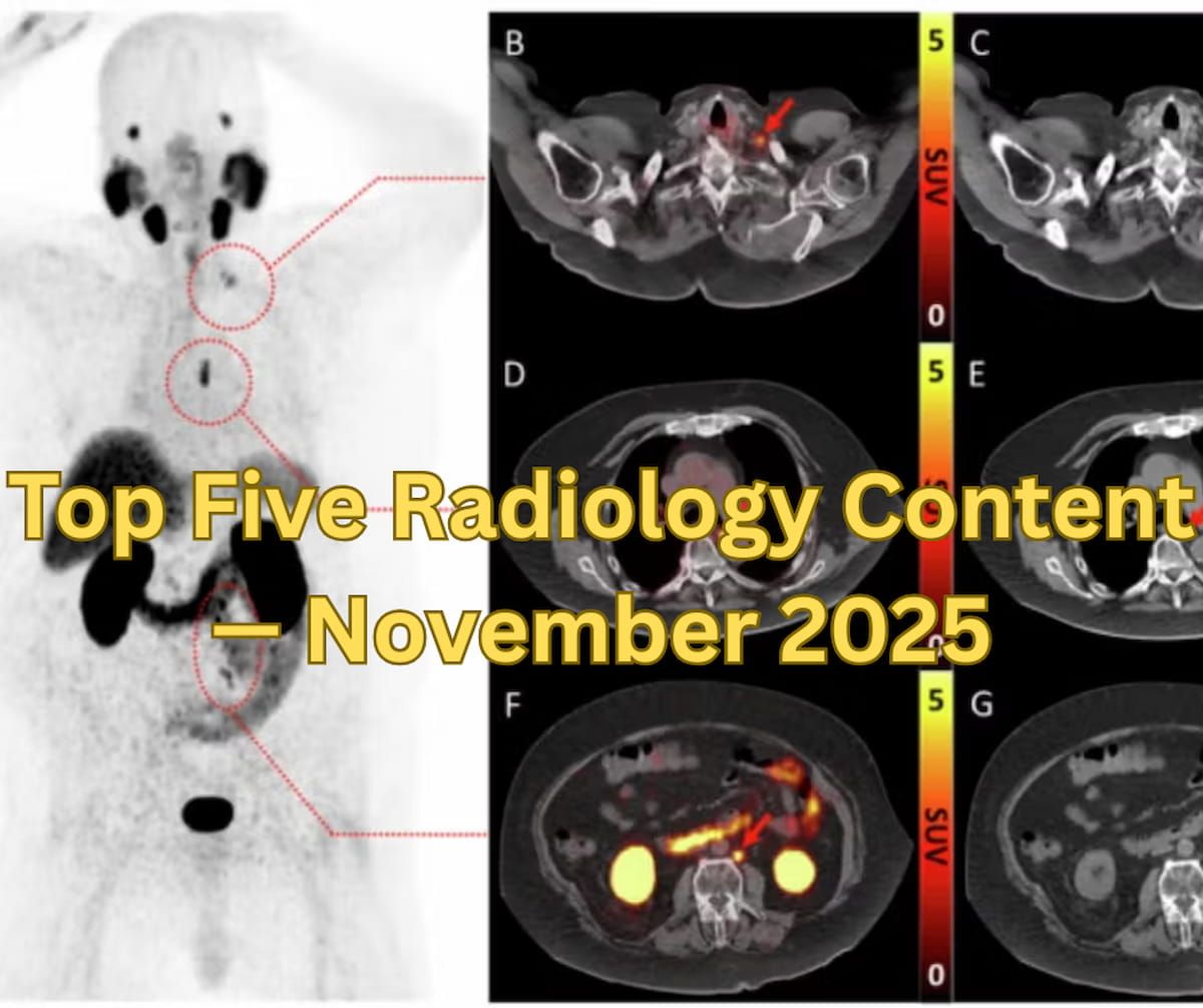 Top Five Radiology Content — November 2025