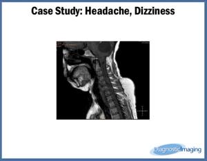 Headache, Dizziness
