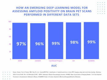 Can Deep Learning Automate Amyloid Positivity Assessment on Brain PET Imaging?