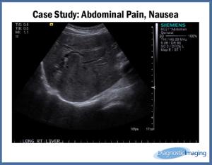 Abdominal Pain, Nausea