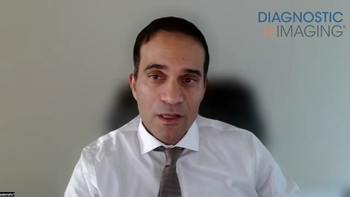 Can CT-Based AI Provide an Objective Biomarker of Chronic Stress?