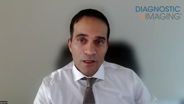 Can CT-Based AI Provide an Objective Biomarker of Chronic Stress?