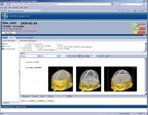 Maturing PACS market gravitates toward regional solutions