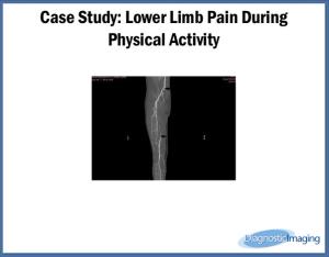 Lower Limb Pain During Physical Activity