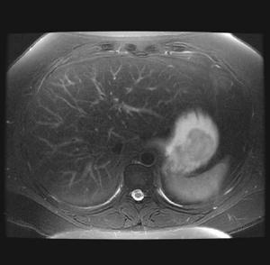 MR exhibitors focus on elastography, innovative design