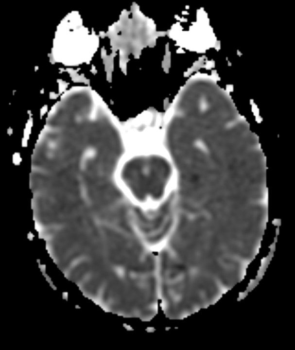 Image IQ Quiz: 57-Year-Old Female with Altered Mental Status