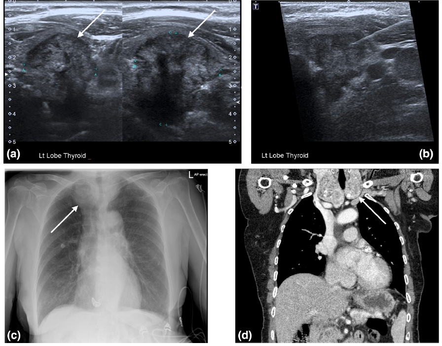 A Closer Look at Ultrasound and MRI Alternatives for Head and Neck Imaging