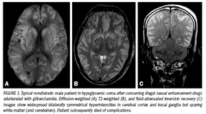 MRI shows damage from illegal sex drugs