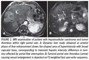 CT and MRI drive awareness of vascular liver disorders