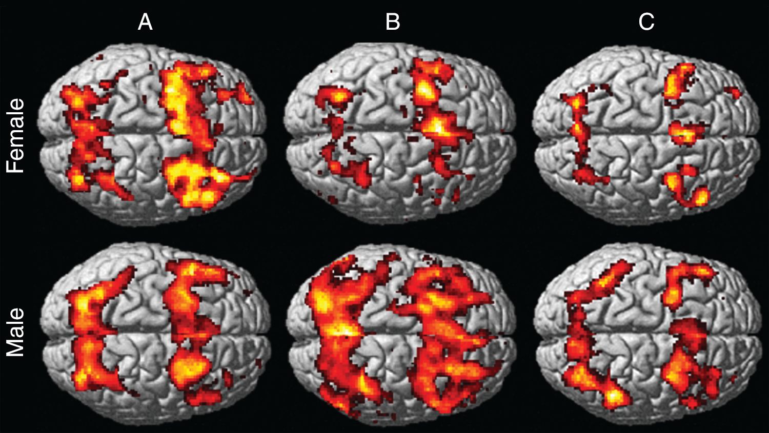 mild-traumatic-brain-injury-drbeckmann