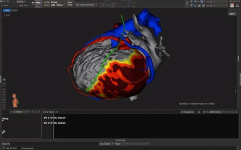 FDA Clears AI-Powered CT Segmentation Tool for Creating 3D Heart Models
