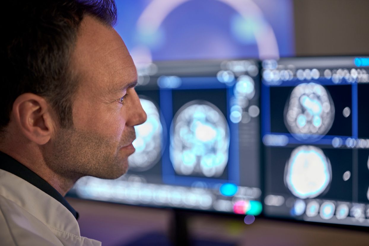 Philips Gets FDA Clearance For AI-Powered And MRI-Enhancing SmartSpeed ...