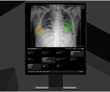 Lunit Unveils Enhanced AI-Powered CXR Software Update