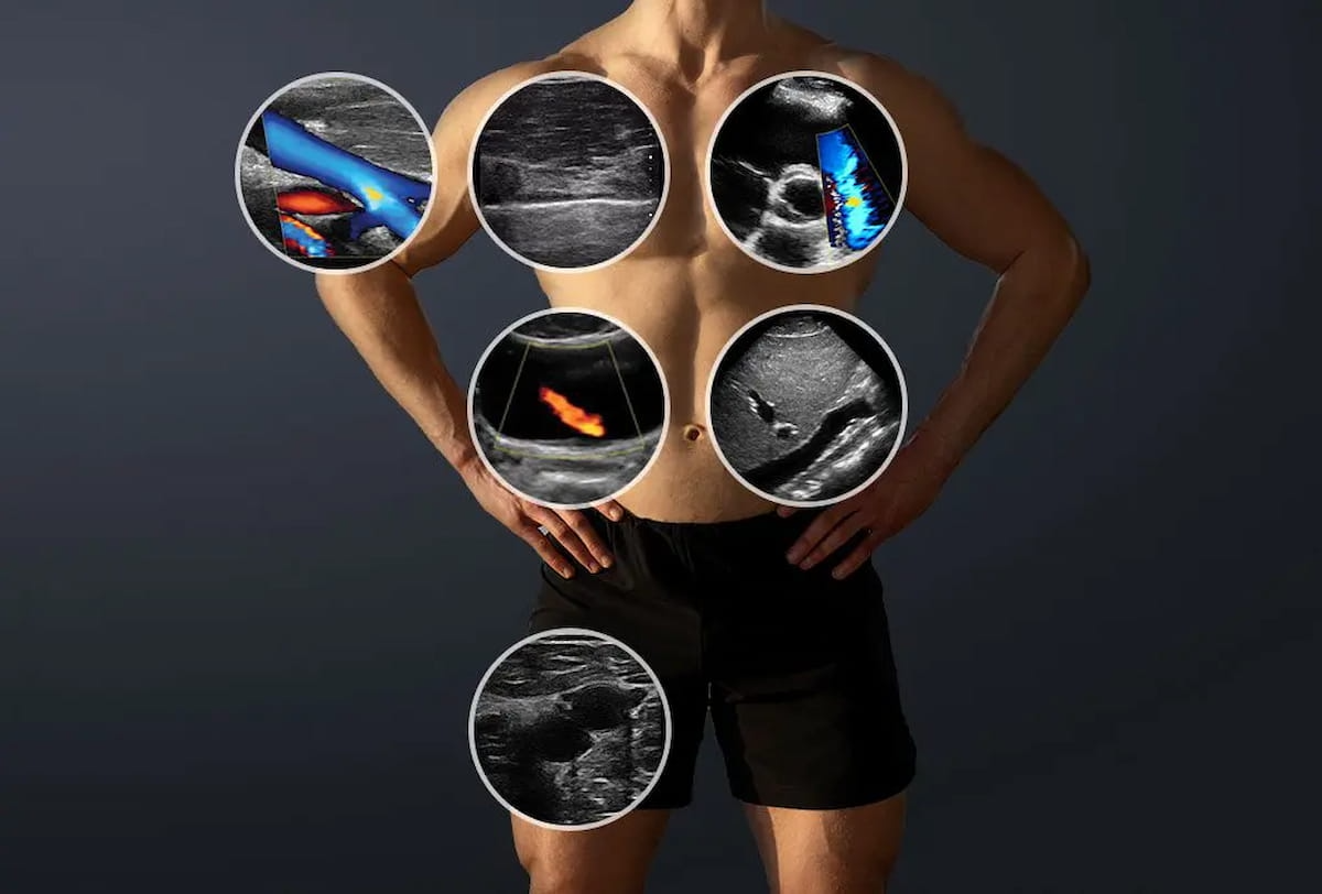 Clarius Launches Dual-Array Handheld Whole-Body Ultrasound Scanner