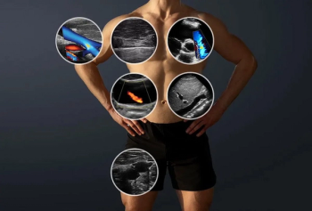 Clarius Launches Dual-Array Handheld Whole-Body Ultrasound Scanner