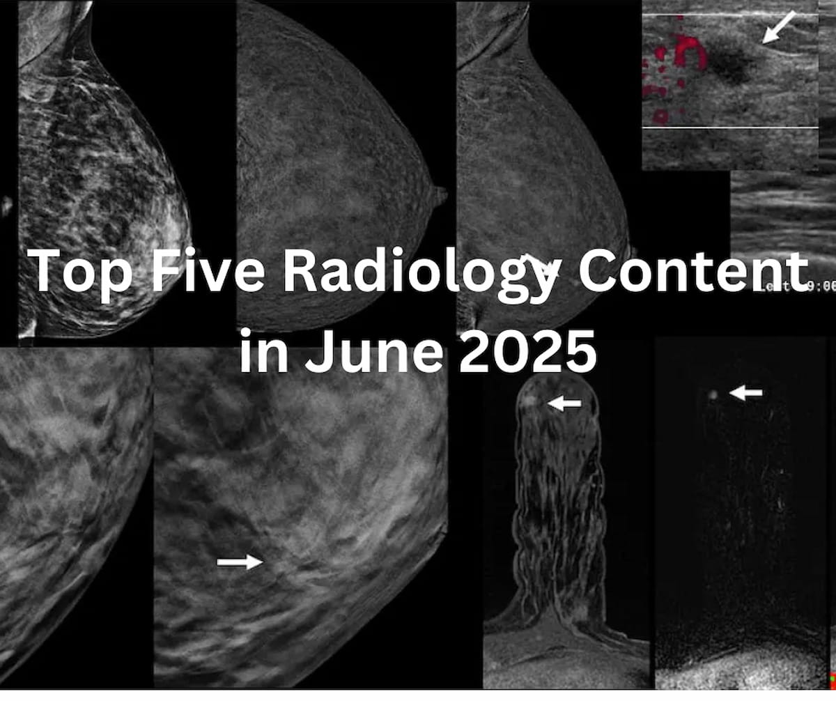 Top Five Radiology Content in June 2025