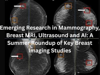 Emerging Research in Mammography, Breast MRI, Ultrasound and AI: A Summer Roundup of Key Breast Imaging Studies