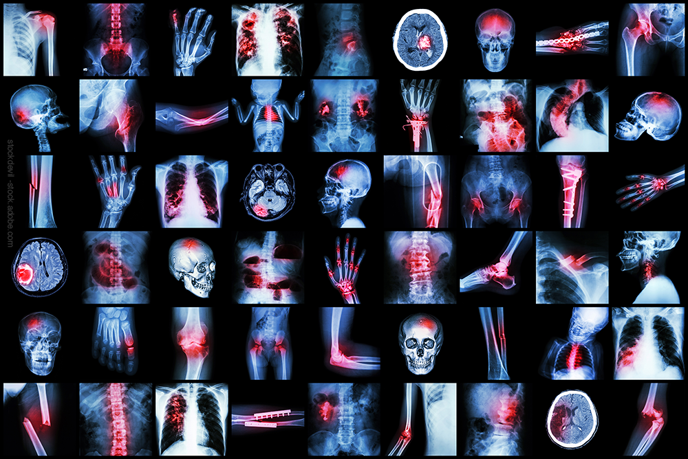 Xray collage