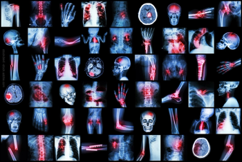 Series of Xray images
