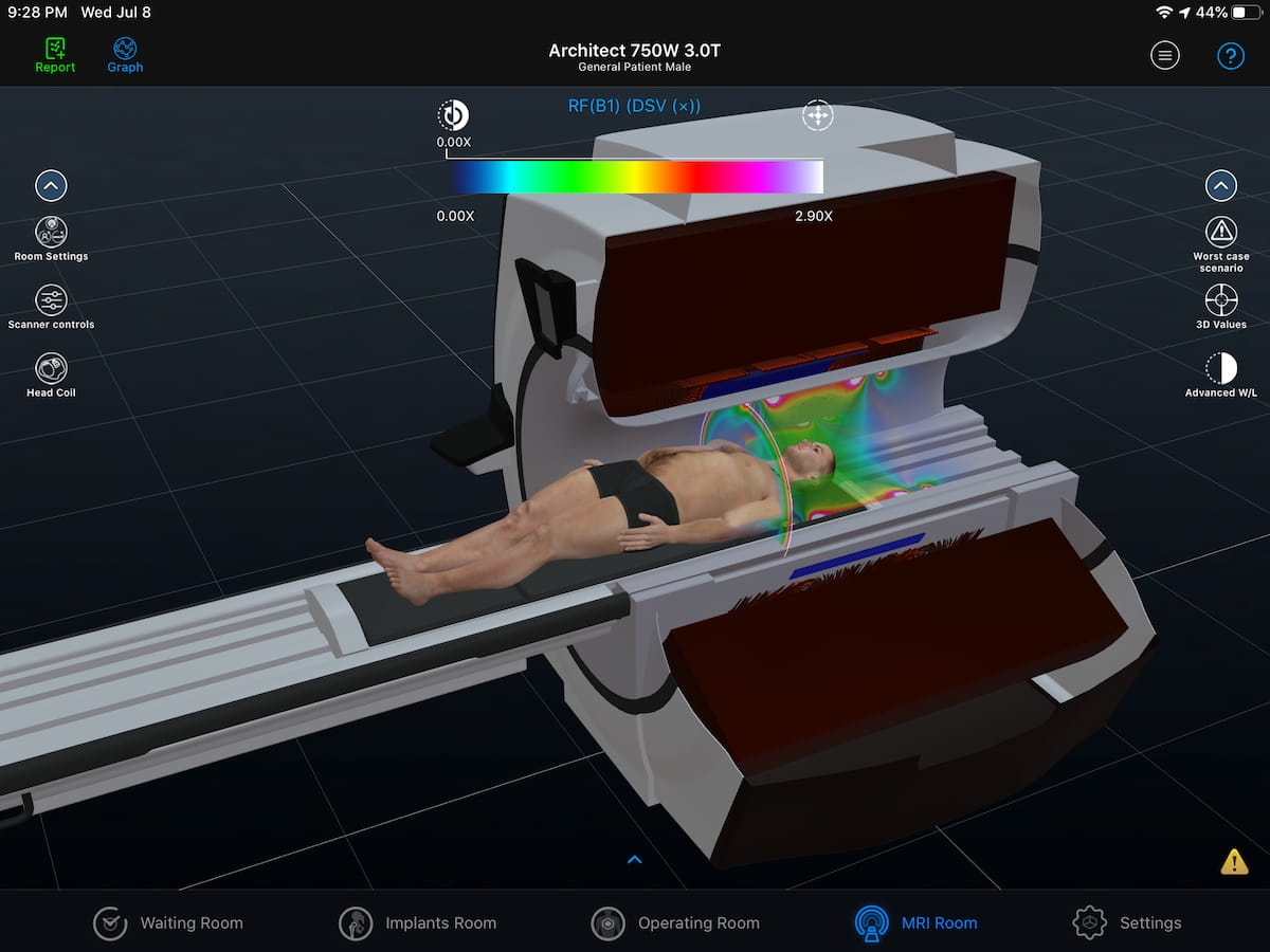 MRI Safety: A Closer Look at Key Factors in Managing Radiofrequency Exposure