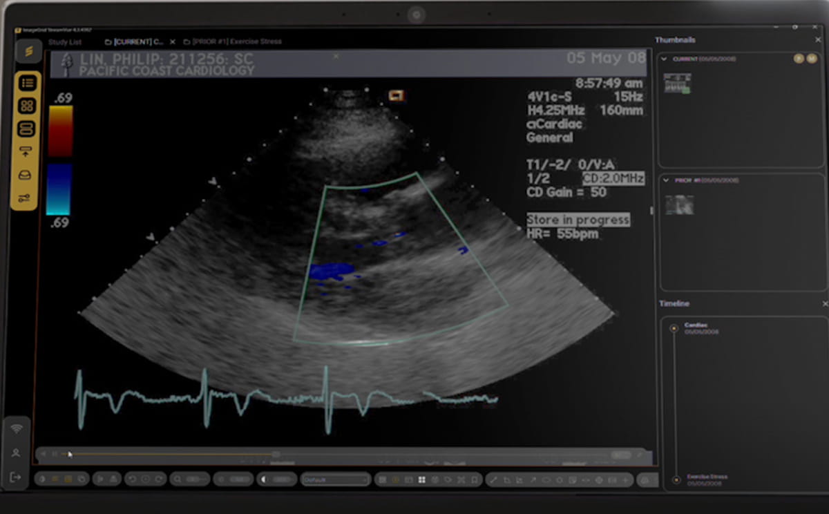 健康・医学 Diagnostic Imaging FDA Issues 510(k) Clearance for Emerging Enterprise Imaging