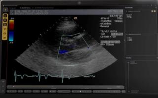 FDA Issues 510(k) Clearance for Emerging Enterprise Imaging Platform