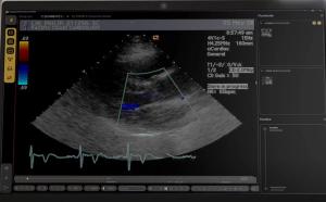 FDA Issues 510(k) Clearance for Emerging Enterprise Imaging Platform