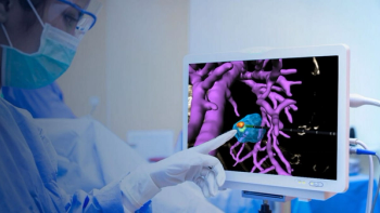 AI-Powered Liver Tumor Ablation Software Leverages CT, MRI and Ultrasound for Real-Time Image Guidance