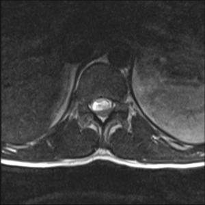 Image IQ: 40-Year Old Man Presents With Low Back Pain